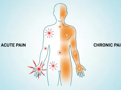 급성 통증과 만성 통증 구별법과 올바른 대처 …